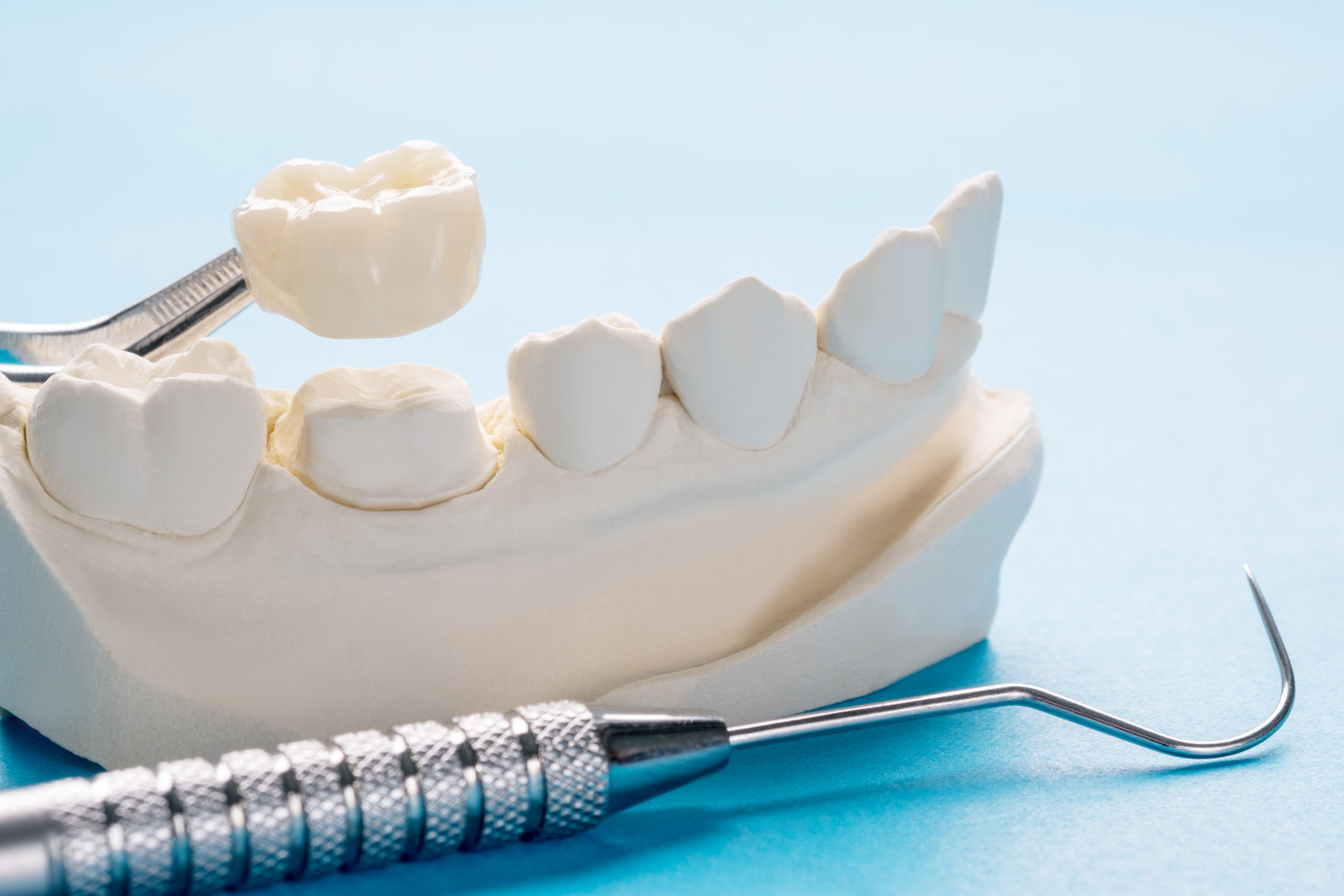 closeup-prosthodontics-prosthetic-single-teeth-crown-bridge-equipment-model-express-fix-restoration
