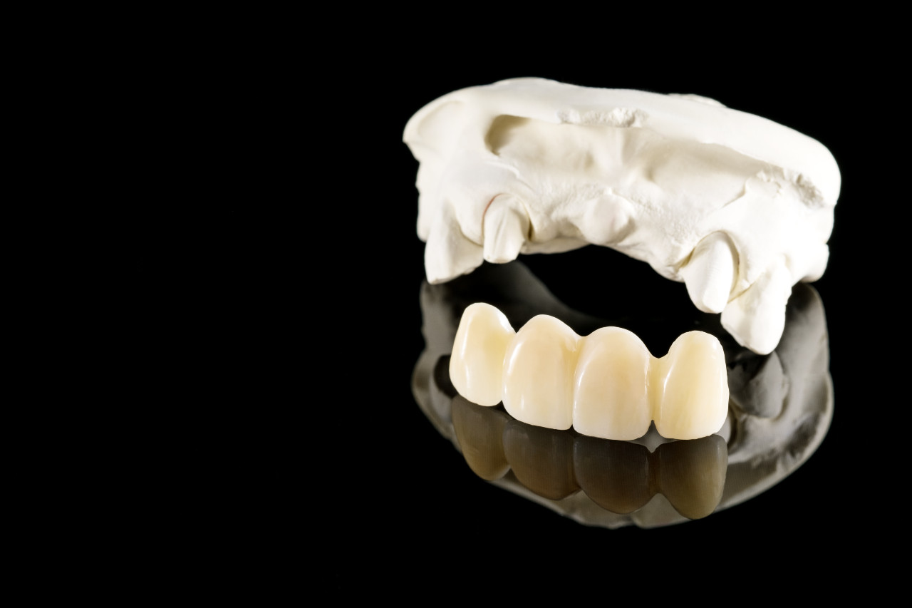 closeup-prosthodontics-prosthetic-tooth-crown-bridge-implant-dentistry-equipment-model-express-fix-restoration