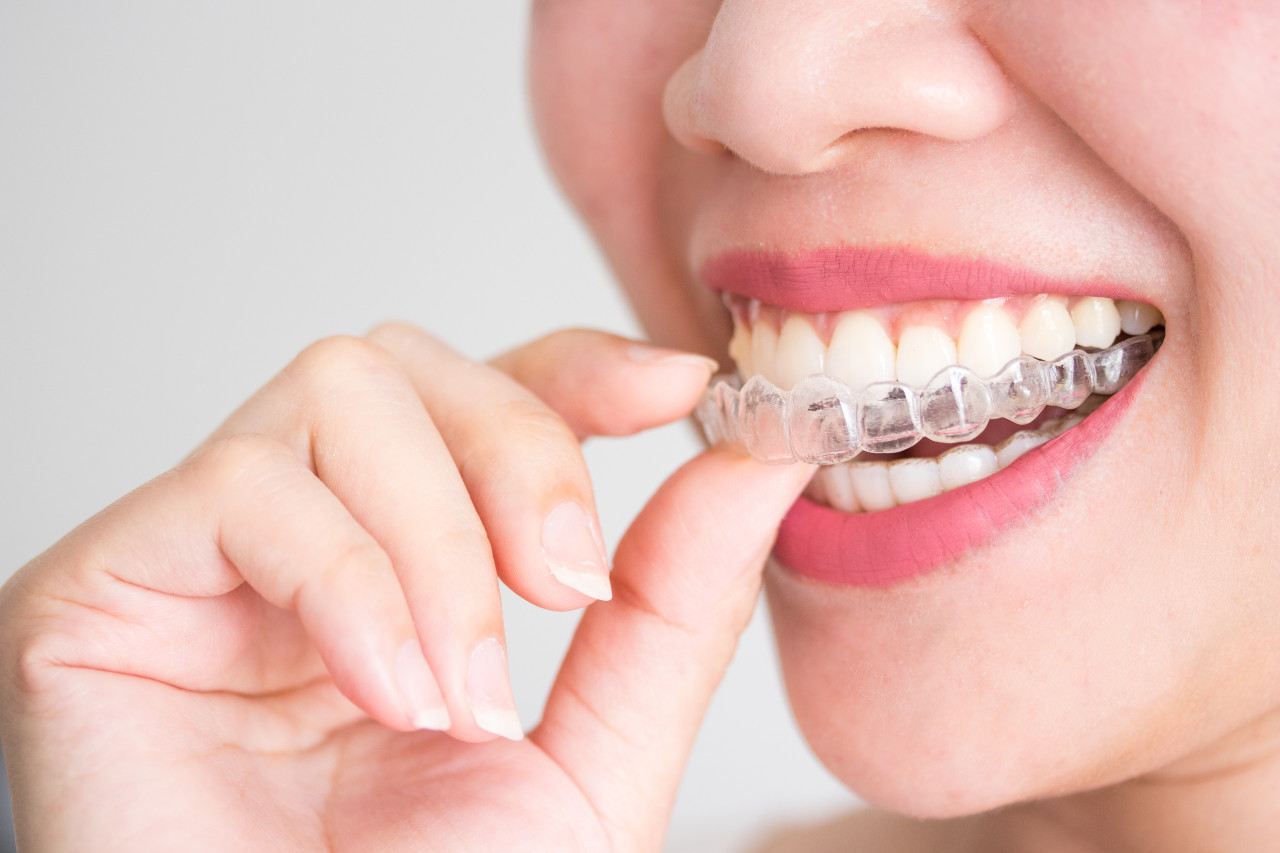smiling-woman-holding-invisalign-invisible-braces